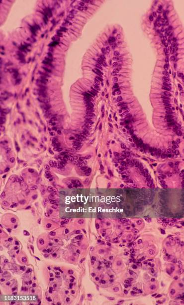 stomach---mucosa, gastric glands, gastric pits, parietal cells, chief cells, mucous cells, 100x - parietal cell stockfoto's en -beelden