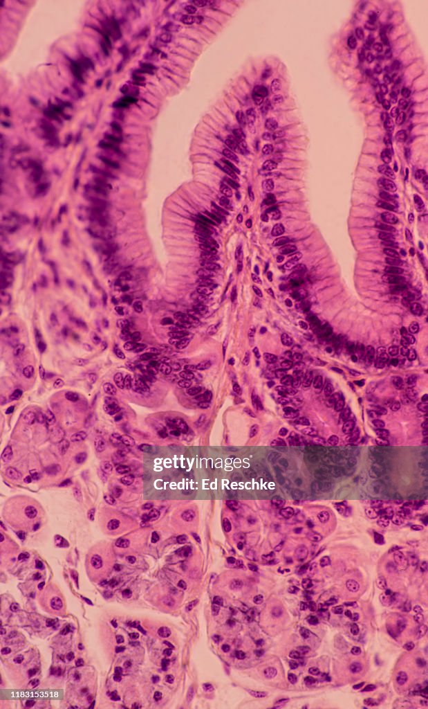 STOMACH---MUCOSA, GASTRIC GLANDS, GASTRIC PITS, PARIETAL CELLS, CHIEF CELLS, MUCOUS CELLS, 100X