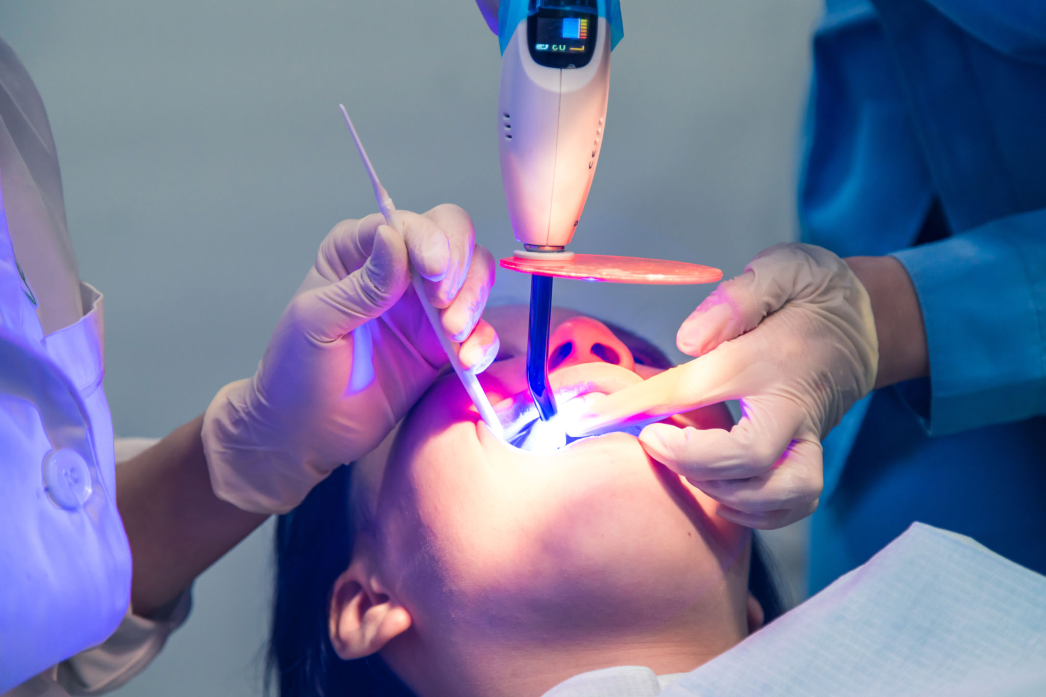 tratamiento laser