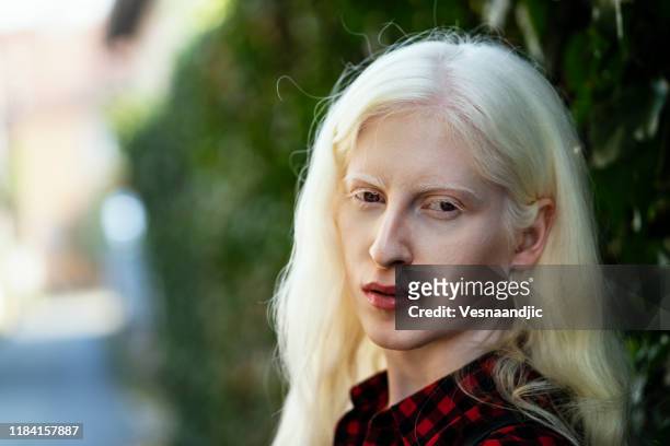 albino girl - white skin stock pictures, royalty-free photos & images
