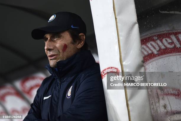 Inter Milan's Italian head coach Antonio Conte, with a red streak on his cheek as part of an initiative targeting domestic violence against women,...