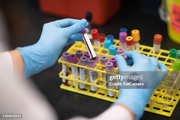 blood vials being placed in a rack stock photo - vial stock pictures, royalty-free photos & images