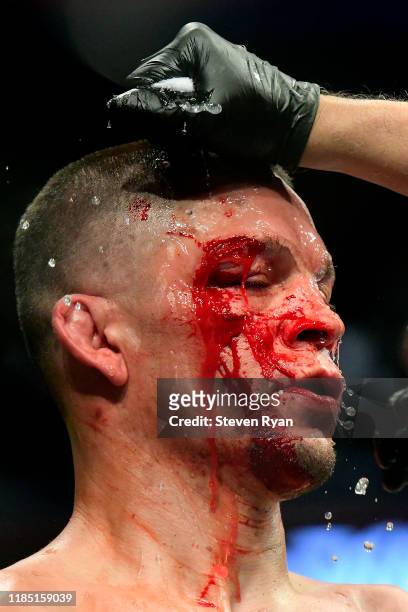 Nate Diaz of the United States has blood washed off his face during the Welterweight "BMF" championship bout against Jorge Masvidal of the United...