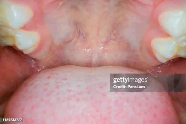 medical check the throat of a child - boca humana imagens e fotografias de stock