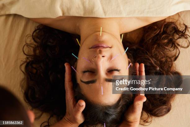 婦女有針灸和氣露治療在她的臉上 - pressure point 個照片及圖片檔