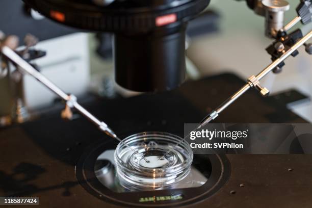 artificial insemination of the human egg. - fertilização in vitro imagens e fotografias de stock