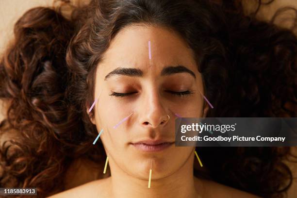 brünette frau mit einer akupunktur-behandlung auf ihrem gesicht - acupuncture stock-fotos und bilder