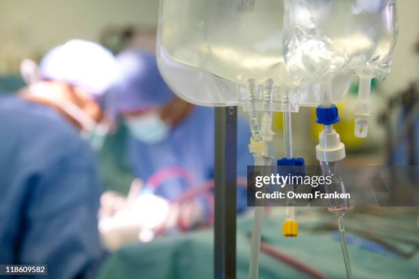operation to remove the liver and kidneys - transplant surgery bildbanksfoton och bilder