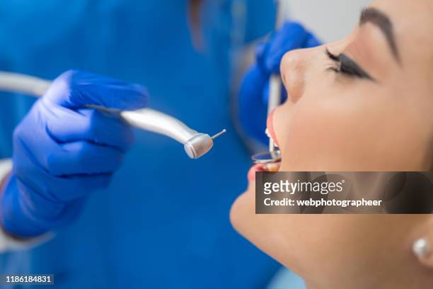 patient öffnet mund für zahnuntersuchung - zahnbohrer stock-fotos und bilder