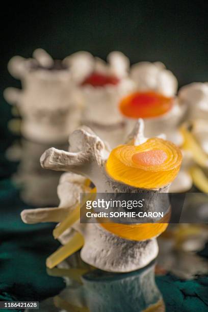 vertebrae and discs. neurodegenerative disease. - decompression sickness stock pictures, royalty-free photos & images