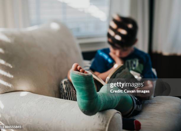 boy with broken leg reading book while relaxing on armchair at home - pierna fracturada fotografías e imágenes de stock