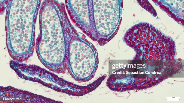 solanum tuberosum potato, histopathology, immunohistochemistry. - light micrograph stock pictures, royalty-free photos & images