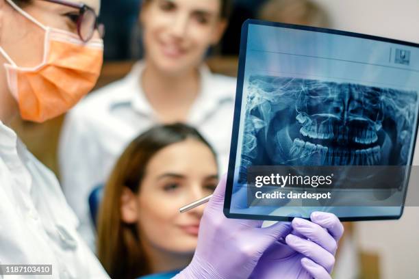 dentist showing an x-ray result - dental imaging stock pictures, royalty-free photos & images