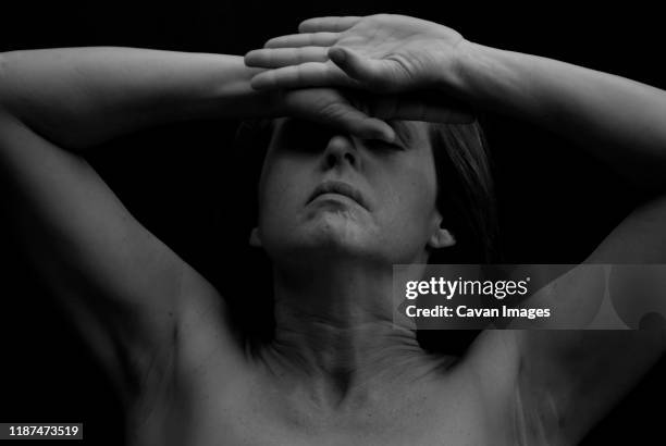 young woman's face with scares due a car crash. in black and white - flower arm fotografías e imágenes de stock