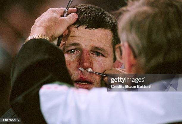 Sean Fitzpatrick of New Zealand is treated for a nosebleed during a Rugby World Cup pool stage match against Ireland at Ellis Park, Johannesburg,...