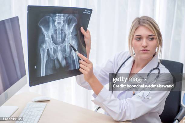 woman doctor looking at x-ray radiography in patient's room - broken trust stock pictures, royalty-free photos & images