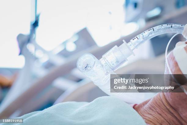 weaning off endotrachel tube giving oxygen to human - beatmungsgerät stock-fotos und bilder