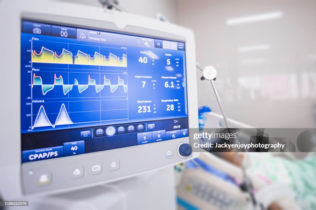 Ventilator monitor ,given oxygen by intubation tube to patient, setting in ICU/Emergency room