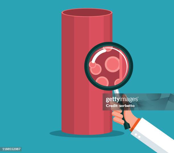 stockillustraties, clipart, cartoons en iconen met bloedvat-vergrootglas - bloedcirculatie