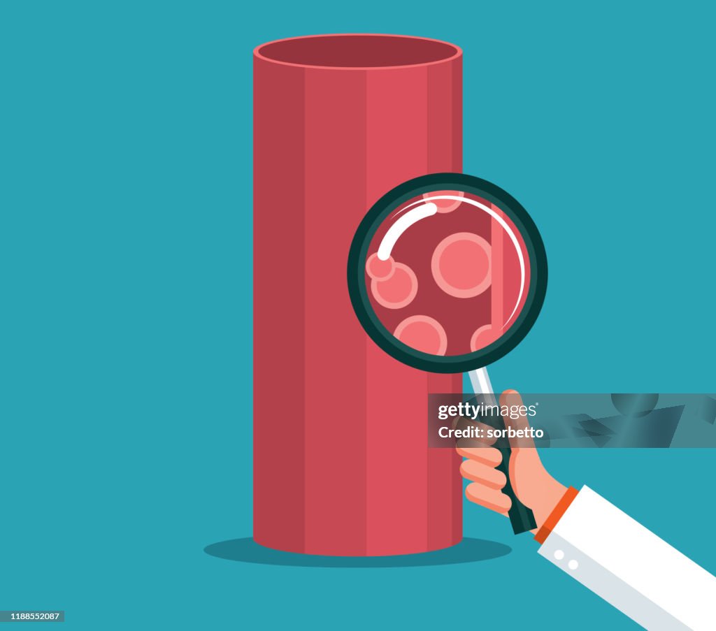Blood vessel - Magnifying Glass