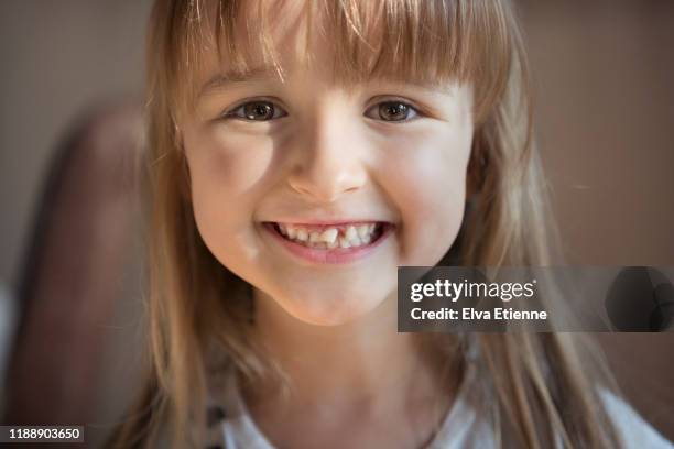 happy smiling child (6-7) with wonky, loose front tooth - wonky fringe stock pictures, royalty-free photos & images