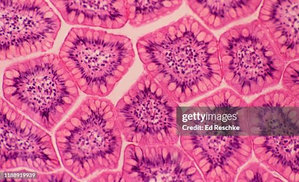 villi in cross section---small intestine (ileum) human, 50x - schleimhaut stock-fotos und bilder