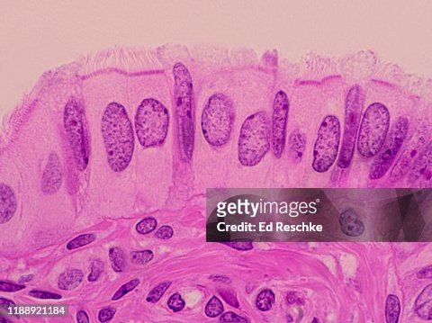 nitrogen Envision Defective Simple Columnar Ciliated Epithelium And Peg Human 250x High-Res Stock Photo  - Getty Images