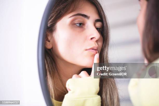 mulher que aplica o creme frio do adore nos bordos na frente do espelho - herpes labial - fotografias e filmes do acervo