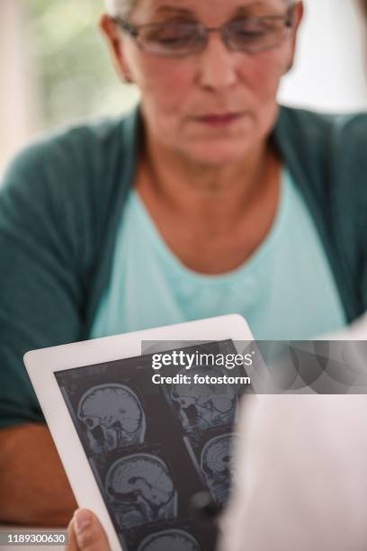 mrt-scan-ergebnisse - hirntumor stock-fotos und bilder