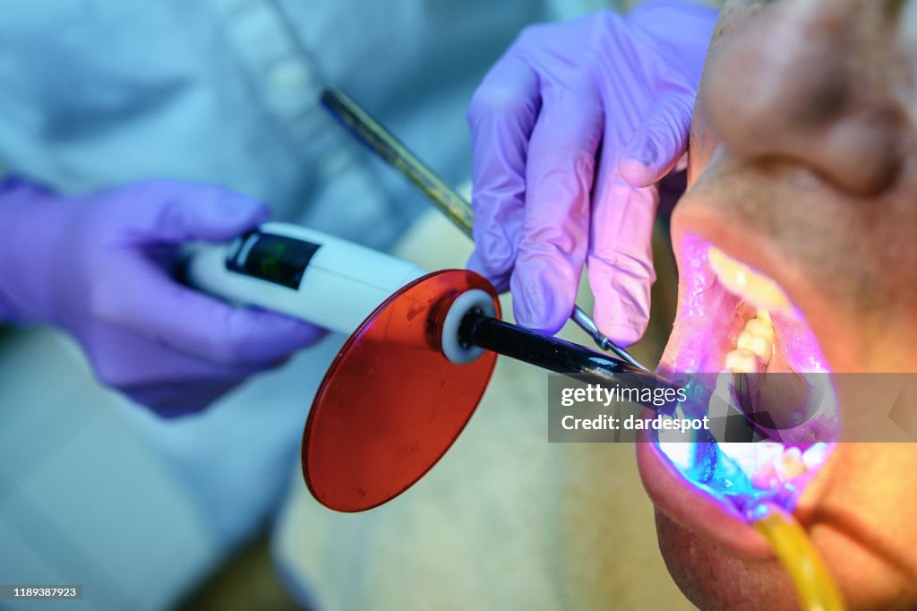 Dentista que usa a lâmpada uv ao tratar os dentes do paciente