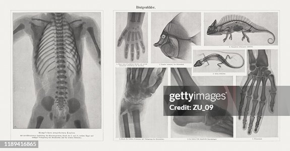 Early Radiography Early Xrays Raster Prints Published In 1898 High-Res Vector Graphic ...