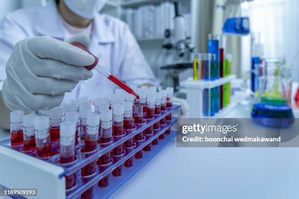 hands of a lab technician with a tube of blood sample and a rack with other samples / lab technician holding blood tube sample for study - blood testing photos et images de collection