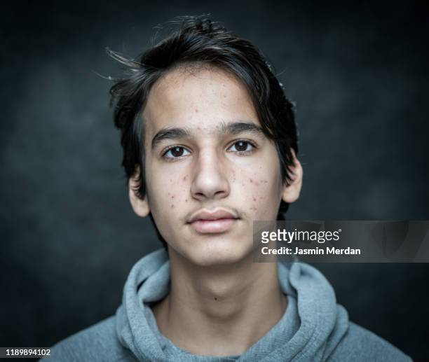 teenage boy with acne portrait - turkish boy stockfoto's en -beelden