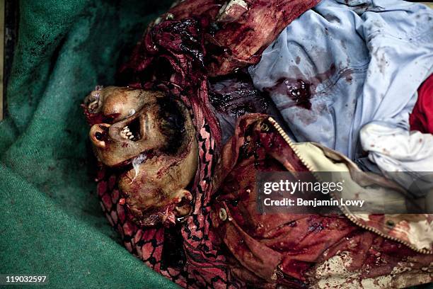 The body of a rebel killed by a large caliber round is stored in the Jala Hospital morgue on March 19, 2011 in Benghazi Libya.