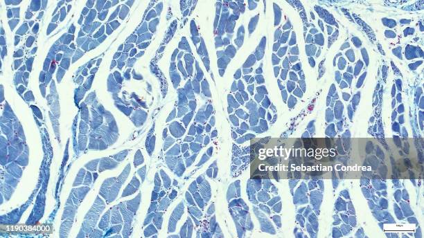 microscopy photography. cardiac muscle section, immunofluorescent photomicrograph, organs samples, histological examination, histopathology on the microscope. - human tissue stock-fotos und bilder