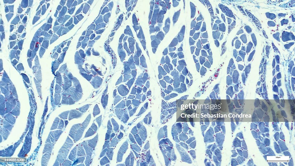 Microscopy photography. Cardiac muscle section, Immunofluorescent photomicrograph, Organs samples, Histological examination, histopathology on the microscope.