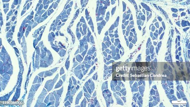 microscopy photography. cardiac muscle section, immunofluorescent photomicrograph, organs samples, histological examination, histopathology on the microscope. - cell bildbanksfoton och bilder