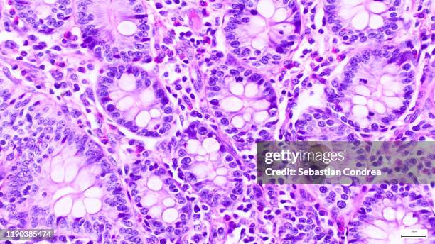 pancreas. serous acini, immunofluorescent photomicrograph, organs samples, histological examination, histopathology on the microscope. - histology stock-fotos und bilder