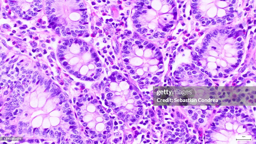 Pancreas. Serous acini, Immunofluorescent photomicrograph, Organs samples, Histological examination, histopathology on the microscope.
