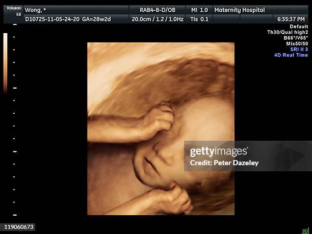 4d scan of ivf baby in womb - fetus stock-fotos und bilder