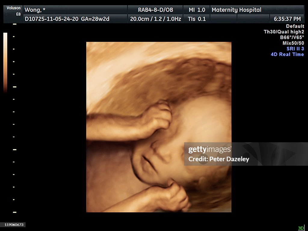 4D scan of IVF baby in womb