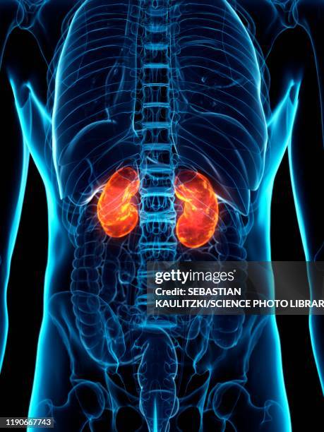 bildbanksillustrationer, clip art samt tecknat material och ikoner med diseased kidney, conceptual illustration - uncomfortable