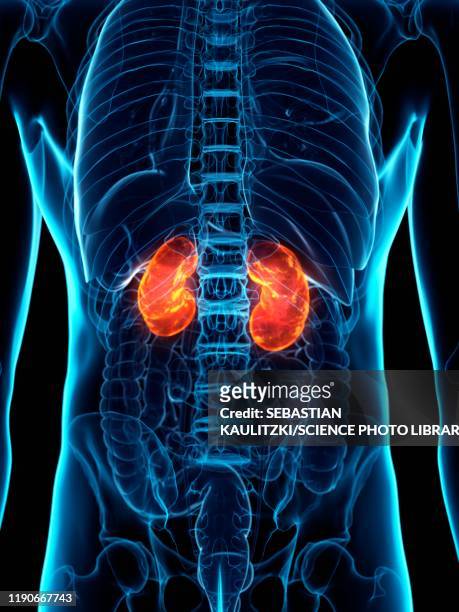 diseased kidney, conceptual illustration - kidneys stock illustrations
