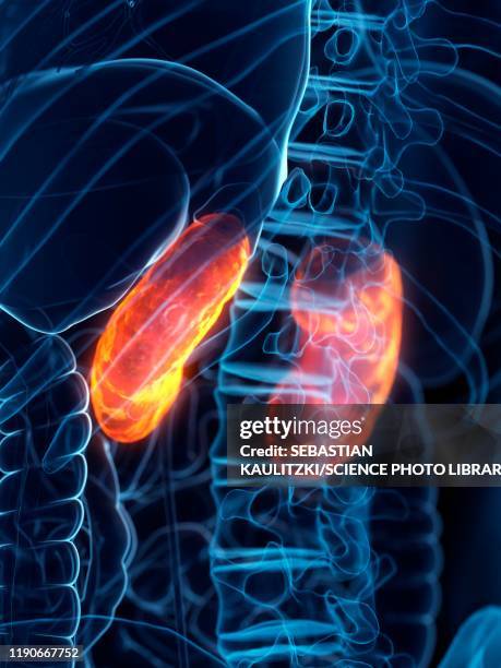 diseased kidney, conceptual illustration - acute angle stock-grafiken, -clipart, -cartoons und -symbole