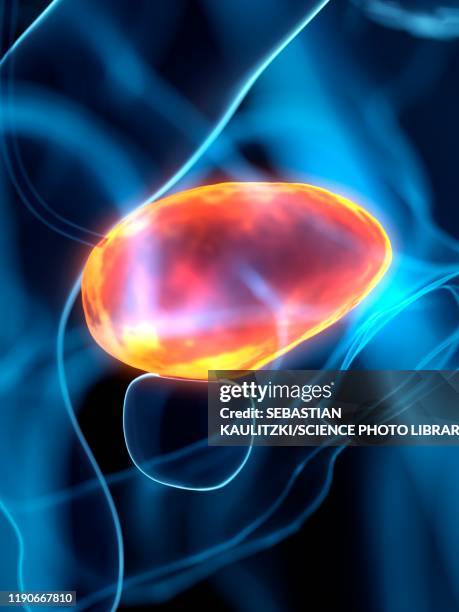 diseased bladder, conceptual illustration - bladder pain stock illustrations