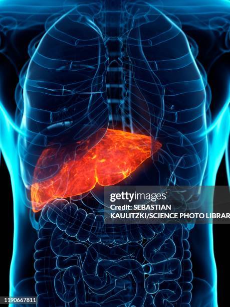 diseased liver, conceptual illustration - liver stock illustrations