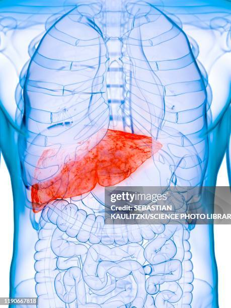 diseased liver, conceptual illustration - adenoma stock illustrations
