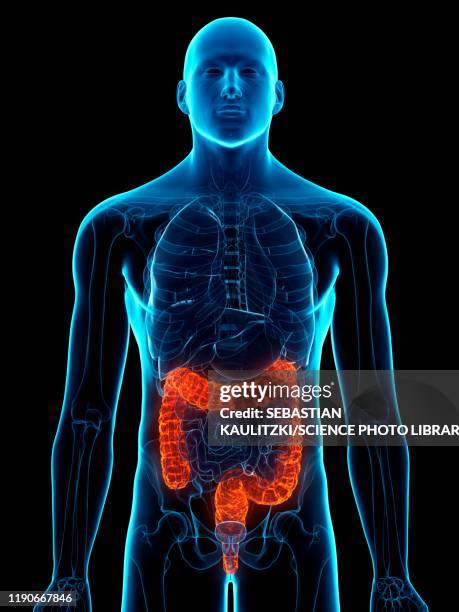 diseased colon, conceptual illustration - ulcerative colitis stock illustrations