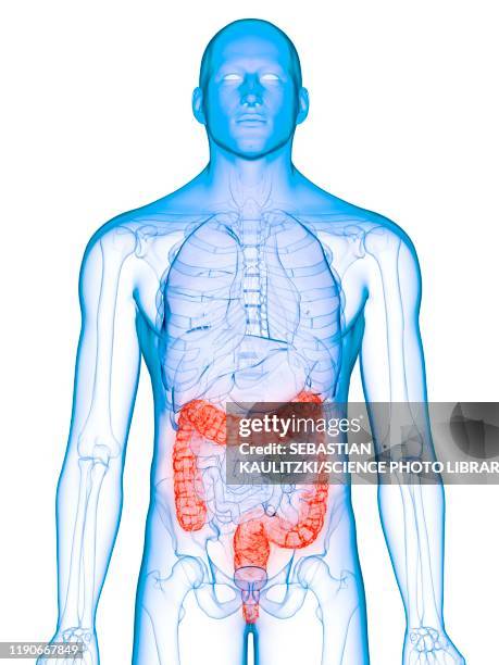 diseased colon, conceptual illustration - inflammatory bowel stock illustrations