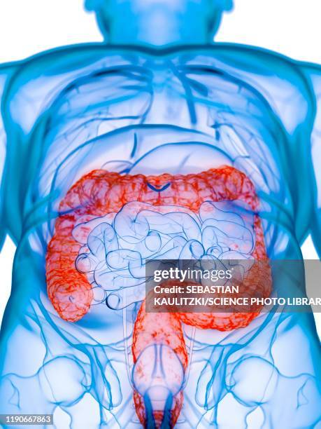 diseased colon, conceptual illustration - inflammatory bowel stock illustrations
